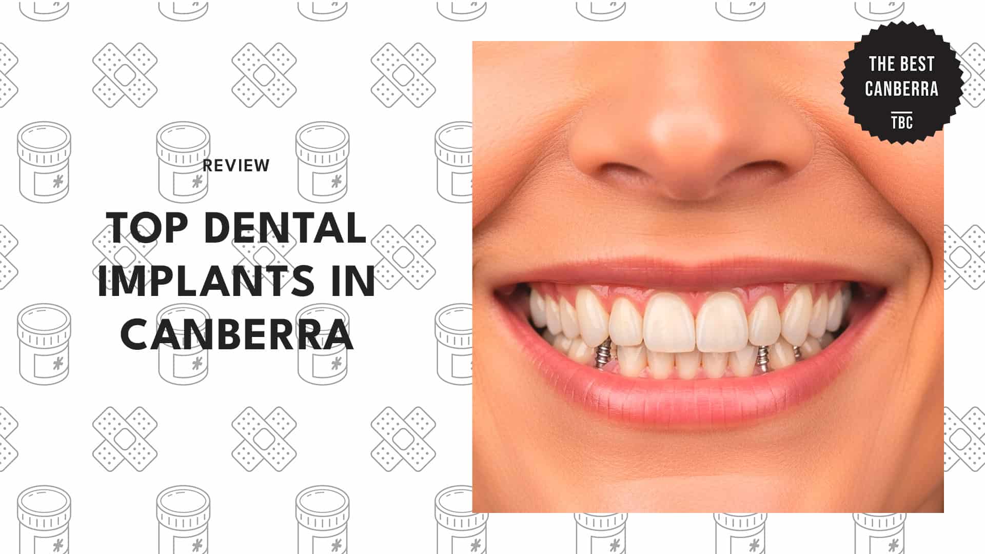 top-dental-implants-canberra-banner